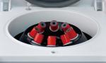 Dental Centrifuge Machine Blood Collection 16×100 Tube