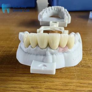 China Highly Translucent Layered Zirconia Crowns Natural With Implant Crown factory