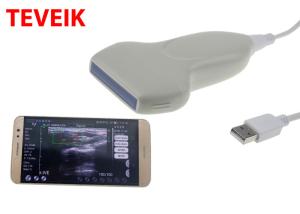 China Smart Phone Wireless Ultrasound Probe , USB Protable Linear Ultrasound Machine factory