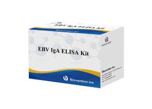 China EBV-VCA IgA Ab Test ELISA Kit Enzyme Immunoassay Test Plasma Specimen factory