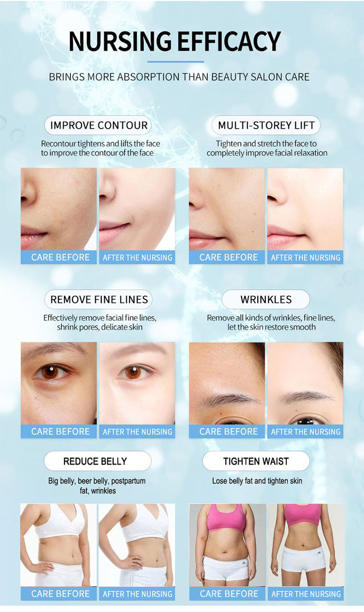 Wrinkle Removal Micro Needle RF And HIFU 2 In 1 Beauty Machine For Face And Body