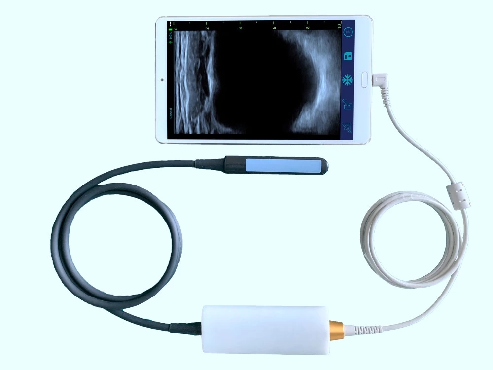 Hot Sale Smart USB Convex Medical Doppler Ultrasound Scanner Ultrasound Probe
