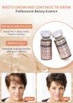 Stalidearm Meso Luxury Hair Loss Treatment Promotes Stimulates Hair Roots