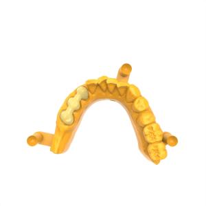 China 92 Shore Permanent Crown Bridge Resin with Breaking Elongation Rate of 5.5-7.3% factory