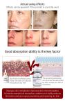 derma Meso Serum Microneedling 10ml Brightening Caviar Anti Aging Serum