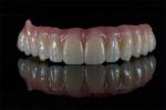 China Dental Lab All On 4 Bridge Full Arch Implant Bridge In Demistry
