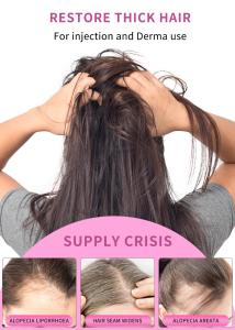 China Stalidearm Hair Growth Meso Serum Anti Hair Loss Dermal Fillers 5ml*5vials factory