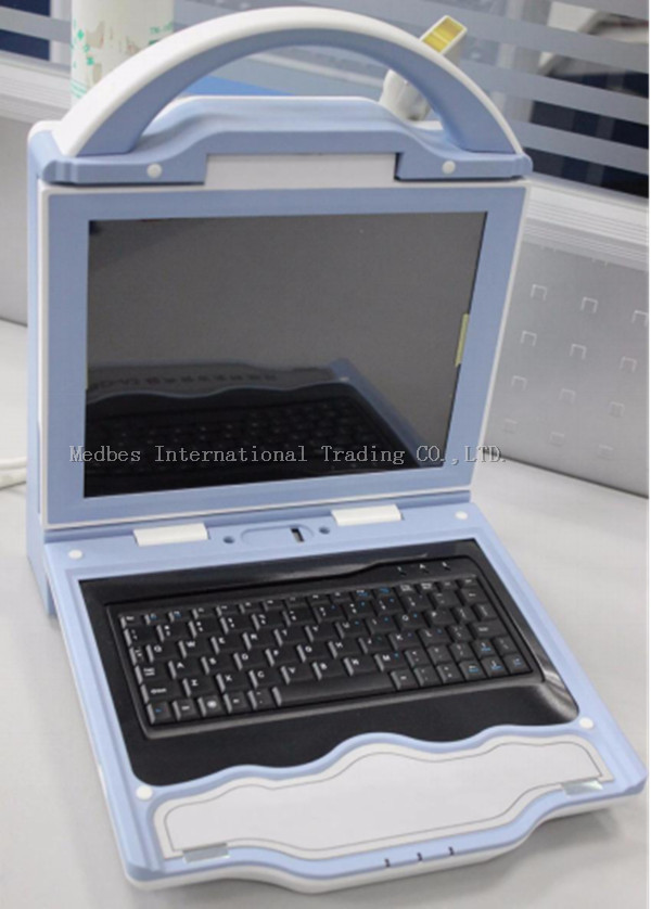Automatic High Effective Portable Ultrasound Bone Densitometer with Built-in Printer
