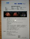 Single Side Printing 0.10Mm Laser X Ray Film For Hospital