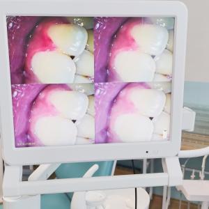 China Dental Endoscope With 17 Inch Monitor Wifi Handheld Portable Dental Camera Intraoral Endoscope Intra Oral Camera factory