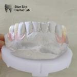 Natural Smile Dental Valplast Dentures Flexi Valplast Removable Partial Denture