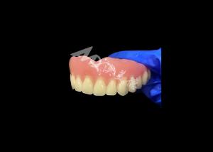 China Full Arch Acrylic Denture An Affordable Solution for International Removable Denture Needs factory