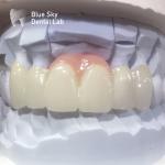 Layered Zirconia Crowns Pink Porcelain Zirconia Dental Crown For Aesthetic