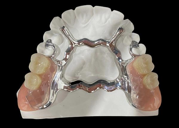 Metal Base and Acrylic Resin Partial Removable Denture for a Secure Fit and
