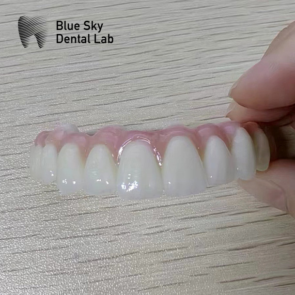 PMMA Bridge Implant Cases For Smooth Surface Implantation Scenarios