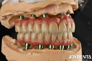 China Hybrid Technology Titanium Malong Dental Bridge Adjustable For Aesthetic Results factory
