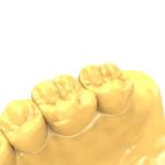 Dental Model Repair Biocompatible Resin Kit ASTM D2204 Safe And Effective