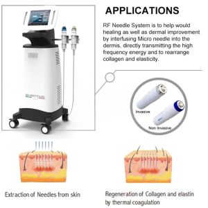 Most Advanced Fractional Rf Microneedle Machine/ Rf Microneedle Radio Frequency