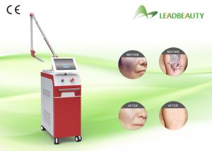 China New 1064nm &amp; 532nm Q Switch ND Yag Laser Tattoo Removal Machine factory