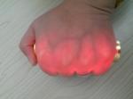 Blood Analysis System Infared Vein Finder Lightweight No Radiation