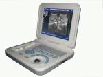 OEM Diagnostic Ultrasound Machines Digital Ultrasound Scanner Durable