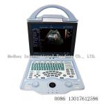 2 ultrasonic transducer Portable3D Color doppler ltrasound Scanner portable