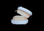 IPS Emax Veneers Natural Looking Restorations For Esthetic Smiles