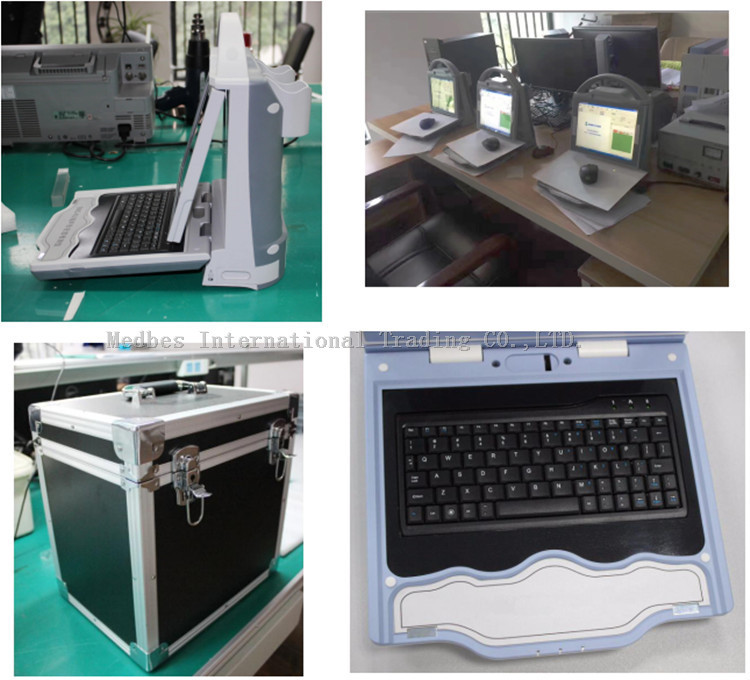 Automatic High Effective Portable Ultrasound Bone Densitometer with Built-in Printer