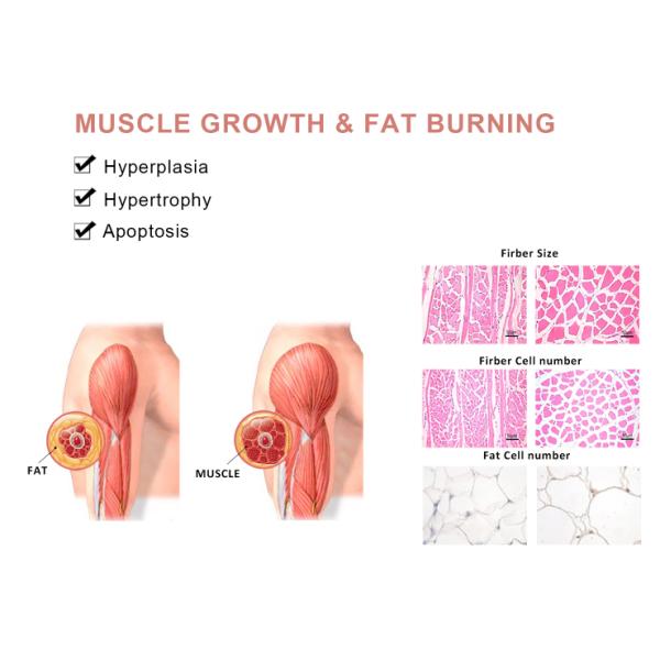 3 In 1 Smart Tecar Pain Relief Physical Therapy Ems Shockwave Machine For ED Treatment