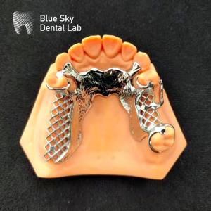 China Skelete Chrome Metal Partial Denture Printed CoCr Denture Design factory