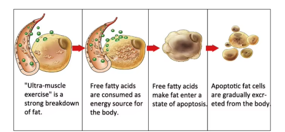 Ems Rf 10d Max Master Red Green Light Machine For Cellulite Removal Fat Burning