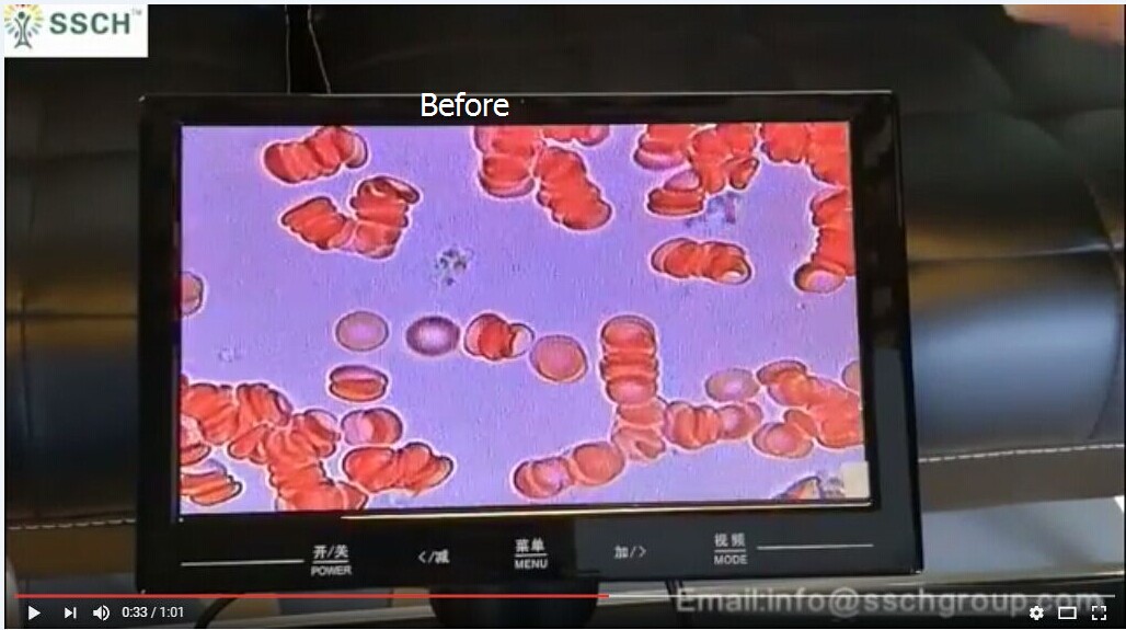 before.jpg