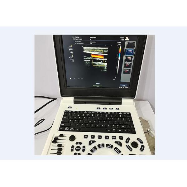 Portable Laptop Handheld Bladder Scanner Color Ultrasound System With 2 Probe Connectors
