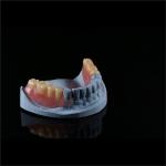 Comfortable Partial Valplast Flexible Dentures Nylon Material