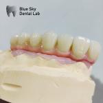 Customized Surgical Smooth Steam Sterilization Universal Compatibility Implant