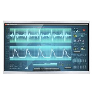 China 11.6 Inch IPS 1920x1080 Wide Temperature TFT Display Sunlight Readable factory