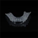 Custom Dental Lab Mouth Michigan Night Guard For Teeth Grinding