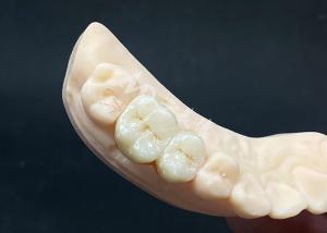 China High Translucency Zirconia Crown Natural Looking Design with Chipping Resistance factory