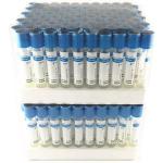 High Quality PRP Tube 10ml 15ml 13ml PRP PRF Tube