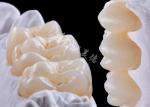 High Strength Zirconia Dental Crown For Single Or Multiple Teeth Replacement