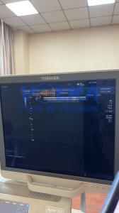 China Canon Toshiba Aplio 50 SSA-700A Linear Vascular ultrasound probe PLT-704AT factory