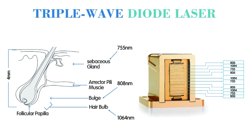 808nm diode laser lumenis lightsheer duet laser for sale