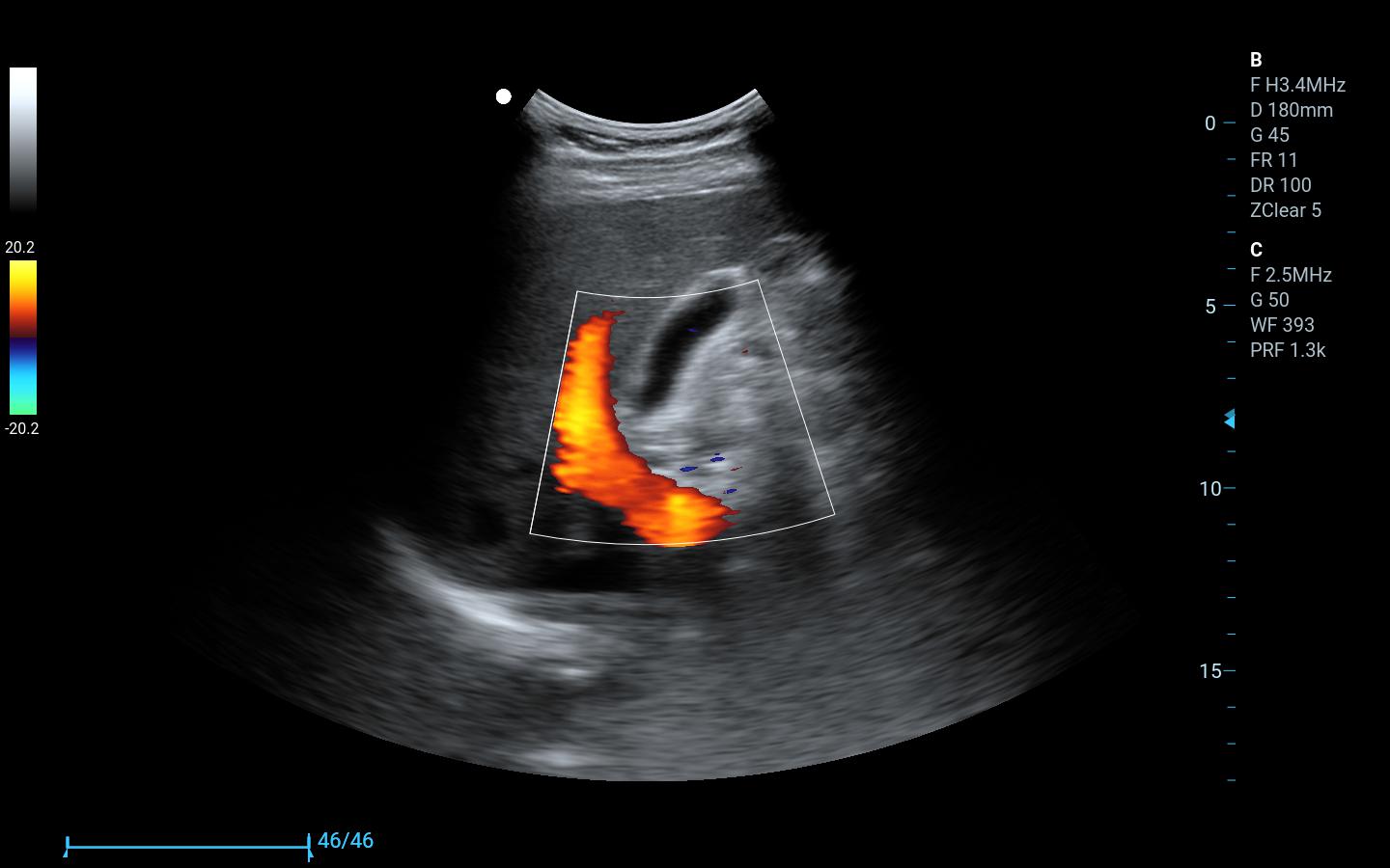 Best Price CW, TDI , PDI Handheld Portable Ultrasonido 3D 4D Veterinary Doppler Ultrasound Machine