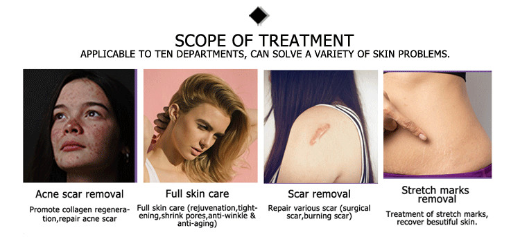 New design in 2021 carbon dioxide 7 hinge joint arm fractional co2 laser medical laser device