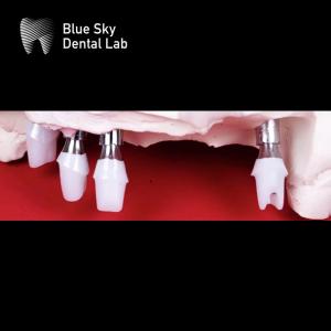 China Blue Sky Dental Implants Zirconia Abutment Precisely Milled factory