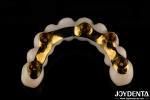 Precision Dental Titanium Bar Hybrid Zirconia Bridge Customization High