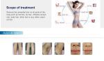12*20mm big spot size 808nm diode laser hair removal machine fast and painless