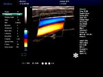 Tender Ultrasound 4D Digital Color Doppler Cheapest Ultrasound Machine Color