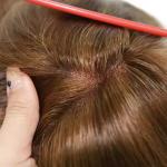 Medical Wig for Alopecia Glueless Human Hair Full Hand-Tied Mono Top Anti-Slip