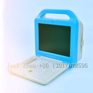 China Medbes Full Digital Ultrasound Scanner Machine Price factory